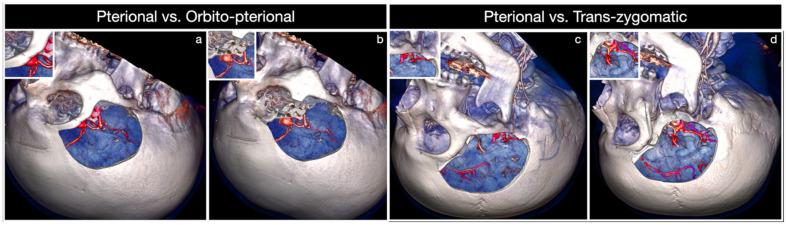 https://cdn.ncbi.nlm.nih.gov/pmc/blobs/682b/8946068/1b523be2dd1b/brainsci-12-00405-g010.jpg