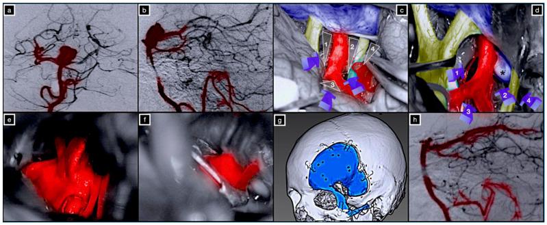 https://cdn.ncbi.nlm.nih.gov/pmc/blobs/682b/8946068/7e37921eb3dd/brainsci-12-00405-g007.jpg
