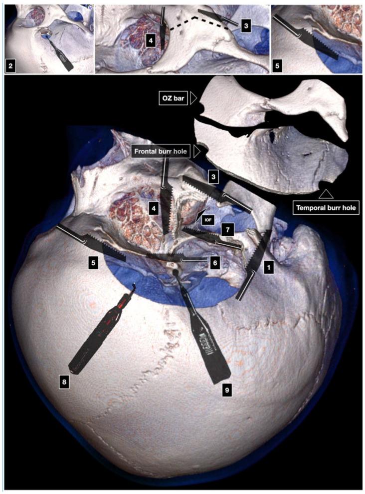https://cdn.ncbi.nlm.nih.gov/pmc/blobs/682b/8946068/e3564dff5296/brainsci-12-00405-g004.jpg