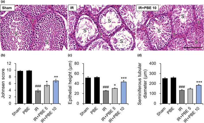 https://cdn.ncbi.nlm.nih.gov/pmc/blobs/682b/9632216/1f9cd6454a8a/FSN3-10-3969-g004.jpg