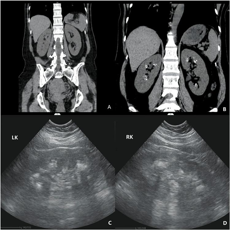 https://cdn.ncbi.nlm.nih.gov/pmc/blobs/6834/9552125/793a081d2167/cureus-0014-00000030160-i01.jpg