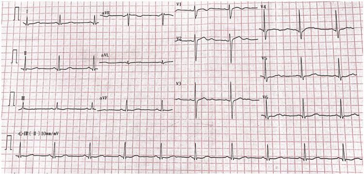 https://cdn.ncbi.nlm.nih.gov/pmc/blobs/6834/9552125/8c22fb46c985/cureus-0014-00000030160-i02.jpg