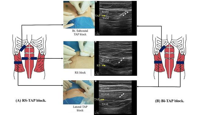 https://cdn.ncbi.nlm.nih.gov/pmc/blobs/6840/11162032/b9cd1edbcfc8/12871_2024_2590_Fig1_HTML.jpg