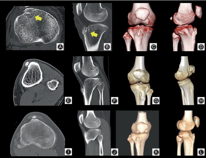 https://cdn.ncbi.nlm.nih.gov/pmc/blobs/684c/11293909/38e09d414788/OS-16-1903-g007.jpg