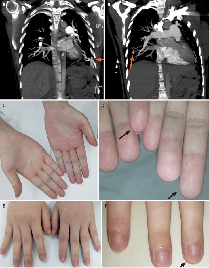 https://cdn.ncbi.nlm.nih.gov/pmc/blobs/6857/11718578/1d7b9b6a7321/98128-g002.jpg