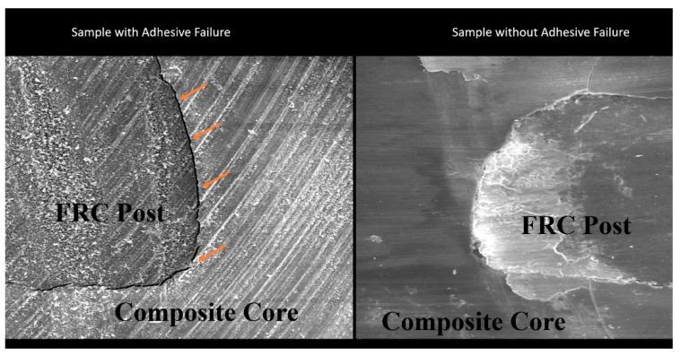 https://cdn.ncbi.nlm.nih.gov/pmc/blobs/6857/9105574/fb894d339a9e/materials-15-03312-g003.jpg