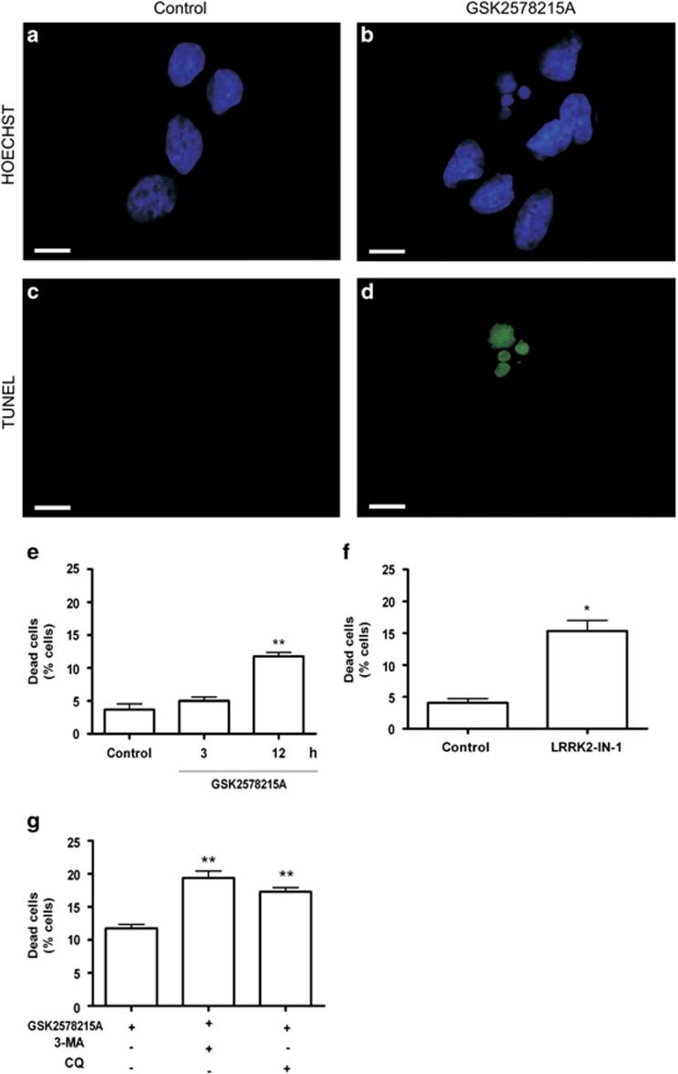 https://cdn.ncbi.nlm.nih.gov/pmc/blobs/685d/4454299/eeeb25578204/cddis2014320f5.jpg