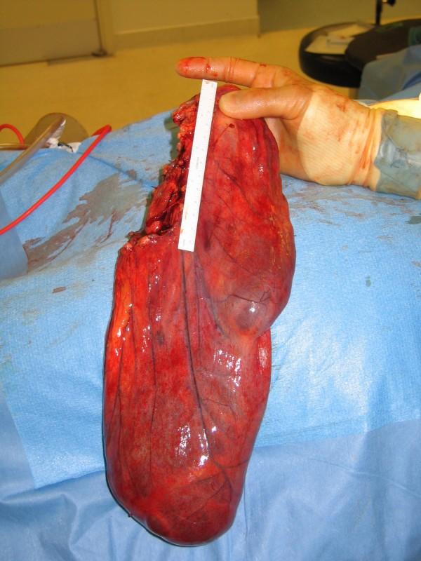 https://cdn.ncbi.nlm.nih.gov/pmc/blobs/6861/2553056/8a84ebdd0fa0/1757-1626-1-147-1.jpg