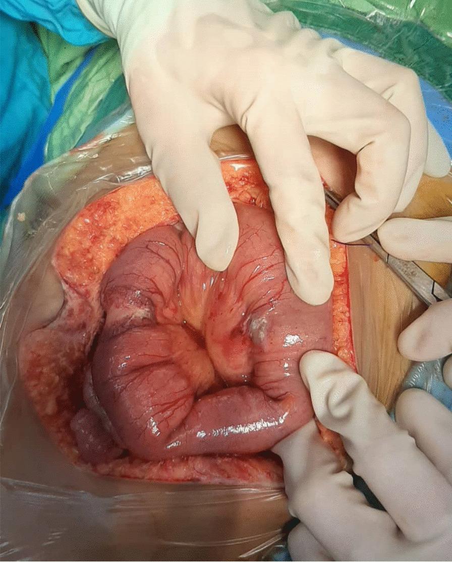 https://cdn.ncbi.nlm.nih.gov/pmc/blobs/6866/8686658/cae60ced6f29/12879_2021_6957_Fig2_HTML.jpg
