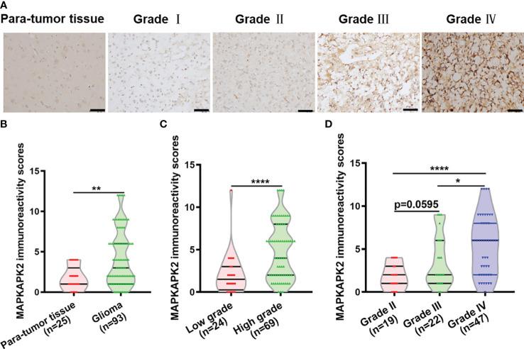 https://cdn.ncbi.nlm.nih.gov/pmc/blobs/6867/10844562/8f5f8b77c186/fonc-14-1307992-g002.jpg