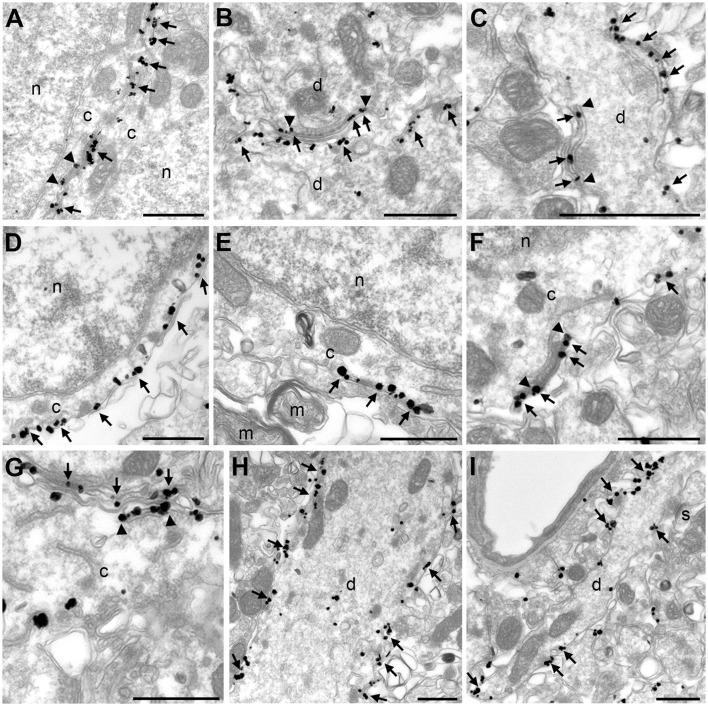 https://cdn.ncbi.nlm.nih.gov/pmc/blobs/6872/5780429/432d3ae6423f/fnmol-11-00001-g0005.jpg