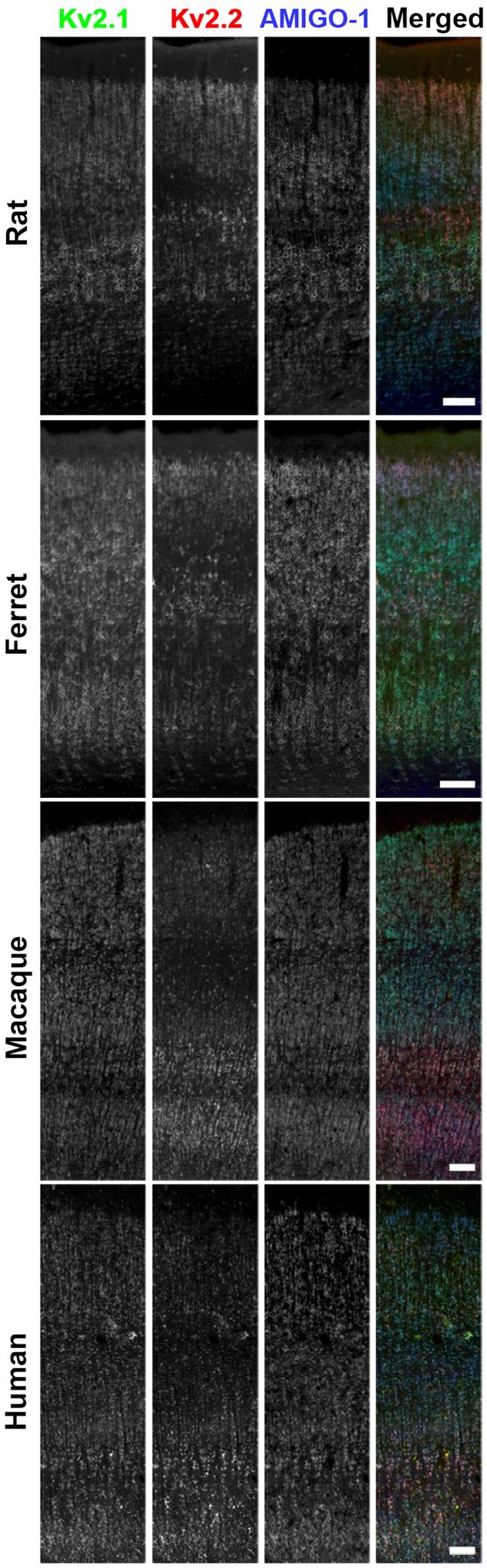 https://cdn.ncbi.nlm.nih.gov/pmc/blobs/6872/5780429/4f0d4dd07f33/fnmol-11-00001-g0003.jpg