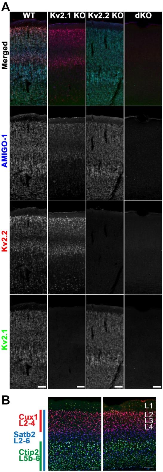 https://cdn.ncbi.nlm.nih.gov/pmc/blobs/6872/5780429/c206e866caa0/fnmol-11-00001-g0008.jpg