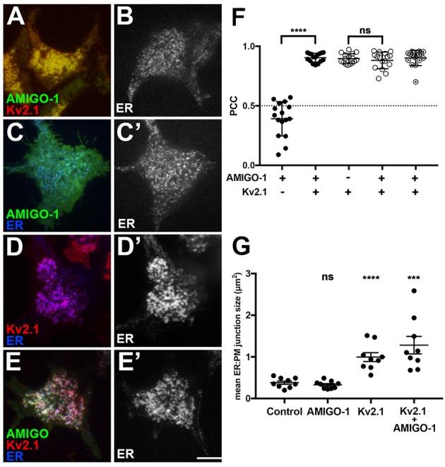 https://cdn.ncbi.nlm.nih.gov/pmc/blobs/6872/5780429/c487360fc63c/fnmol-11-00001-g0007.jpg