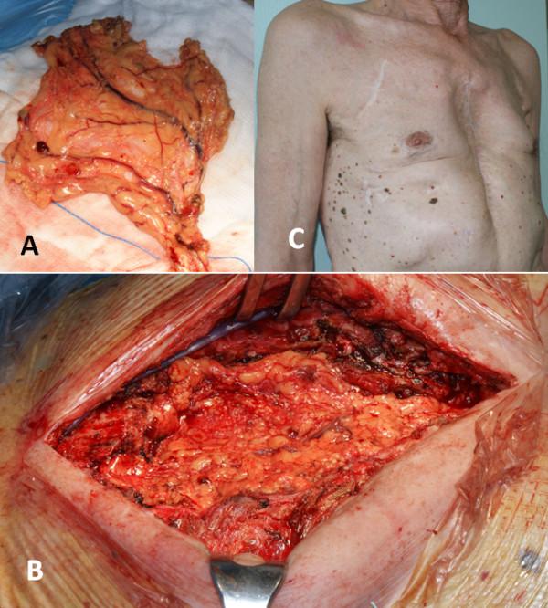https://cdn.ncbi.nlm.nih.gov/pmc/blobs/688b/3598936/bdea7dc86296/1749-8090-8-30-2.jpg
