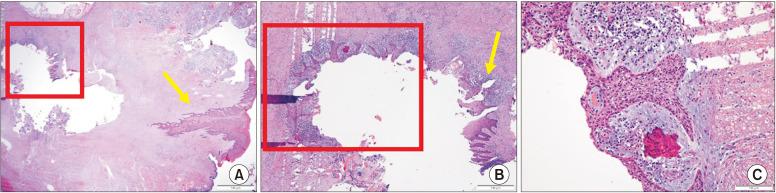 https://cdn.ncbi.nlm.nih.gov/pmc/blobs/689c/8084740/f67e45f124f8/jkaoms-47-2-120-f10.jpg