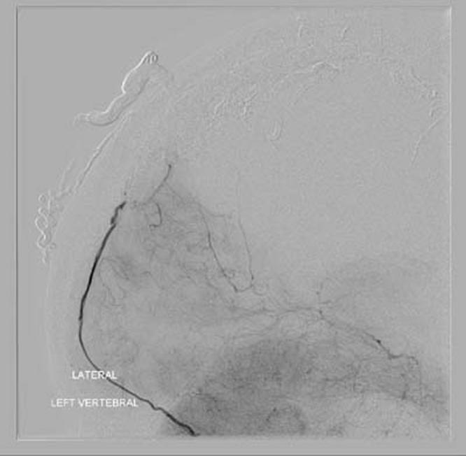 https://cdn.ncbi.nlm.nih.gov/pmc/blobs/689f/4896129/1eab39733bbf/gr13.jpg