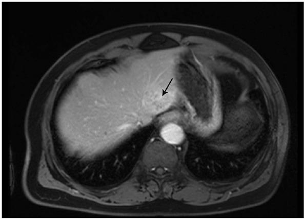 https://cdn.ncbi.nlm.nih.gov/pmc/blobs/68a2/6419389/af815e4cc5c0/med-13-456-g001.jpg