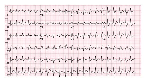 https://cdn.ncbi.nlm.nih.gov/pmc/blobs/68a4/3542936/24da0ac9c9bd/CRIM.EM2012-794019.002.jpg