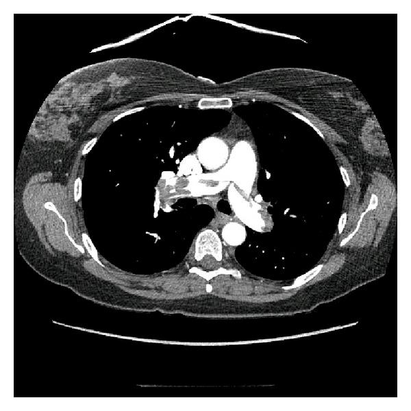 https://cdn.ncbi.nlm.nih.gov/pmc/blobs/68a4/3542936/afc9a765a7db/CRIM.EM2012-794019.003.jpg