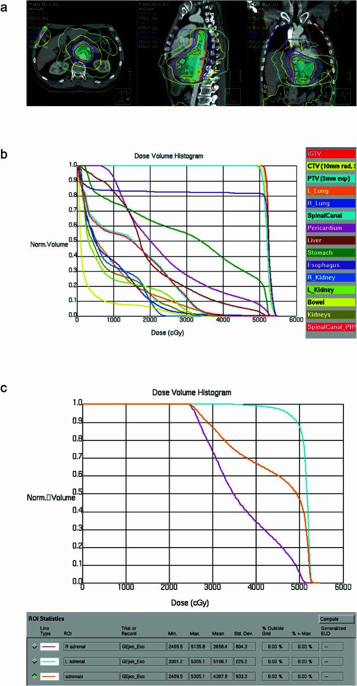 https://cdn.ncbi.nlm.nih.gov/pmc/blobs/68a5/11031406/afb49106779b/41591_2024_2877_Fig7_ESM.jpg