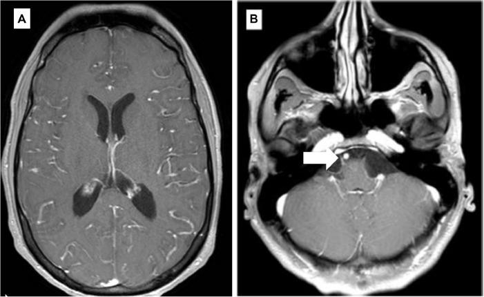 https://cdn.ncbi.nlm.nih.gov/pmc/blobs/68a8/7521157/69eb03780924/fonc-10-01745-g002.jpg