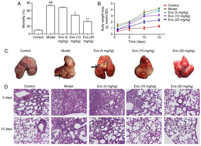 https://cdn.ncbi.nlm.nih.gov/pmc/blobs/68ab/6202108/710a77b178d9/IJMM-42-06-3247-g02.jpg
