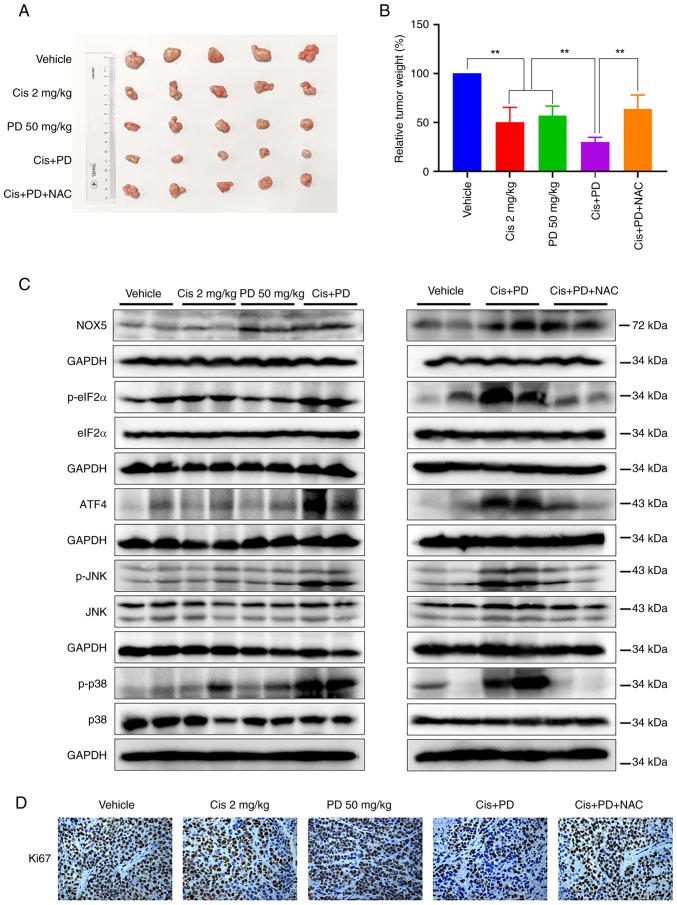 https://cdn.ncbi.nlm.nih.gov/pmc/blobs/68b3/11251743/5066ecc316ed/ijo-65-02-05665-g05.jpg