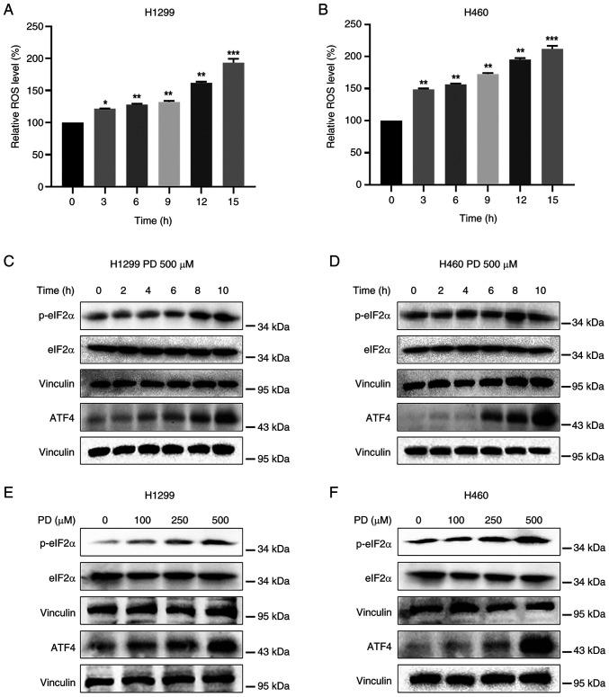 https://cdn.ncbi.nlm.nih.gov/pmc/blobs/68b3/11251743/b8638b2a4fa0/ijo-65-02-05665-g01.jpg