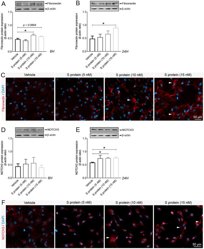 https://cdn.ncbi.nlm.nih.gov/pmc/blobs/68b6/8590447/24162e9508cd/gr3_lrg.jpg