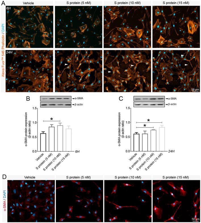 https://cdn.ncbi.nlm.nih.gov/pmc/blobs/68b6/8590447/7780381f266f/gr2_lrg.jpg