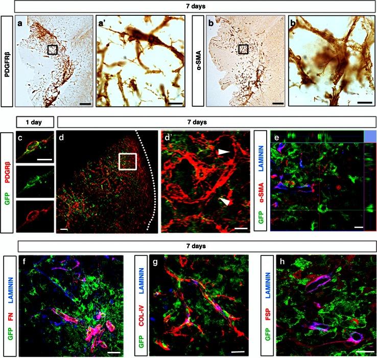 https://cdn.ncbi.nlm.nih.gov/pmc/blobs/68ca/4131168/02964ee39486/401_2014_1295_Fig8_HTML.jpg