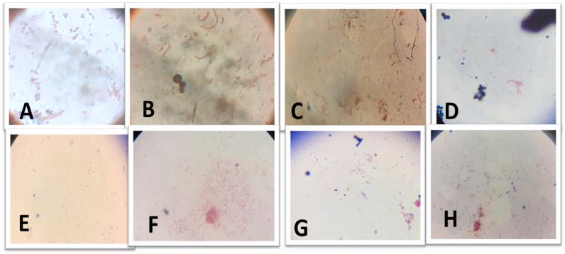https://cdn.ncbi.nlm.nih.gov/pmc/blobs/68ca/9918745/4532371f674d/gr3.jpg