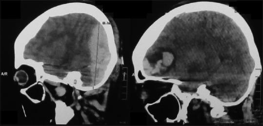 https://cdn.ncbi.nlm.nih.gov/pmc/blobs/68d0/5898130/8ba124147cfd/AJNS-13-453-g002.jpg