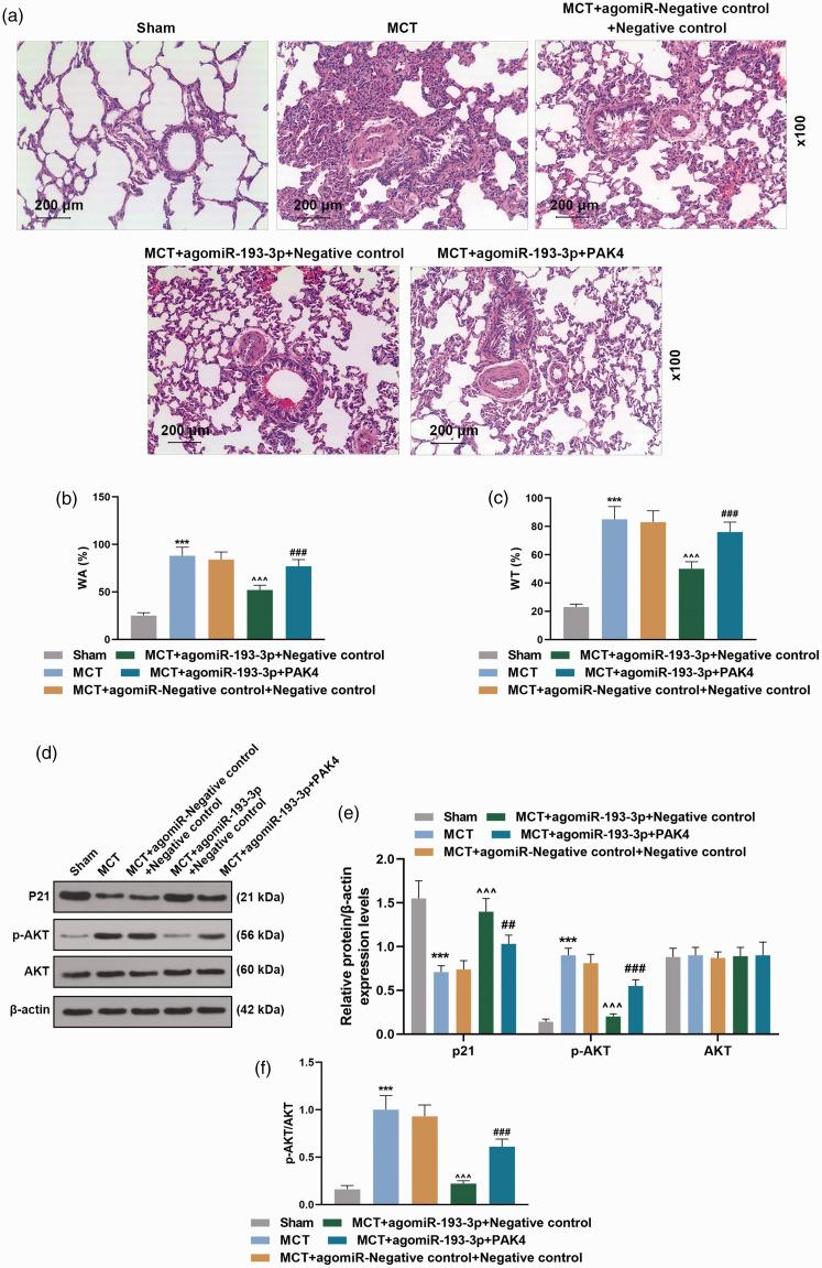 https://cdn.ncbi.nlm.nih.gov/pmc/blobs/68d0/7734527/22590487bf28/10.1177_2045894020974919-fig6.jpg