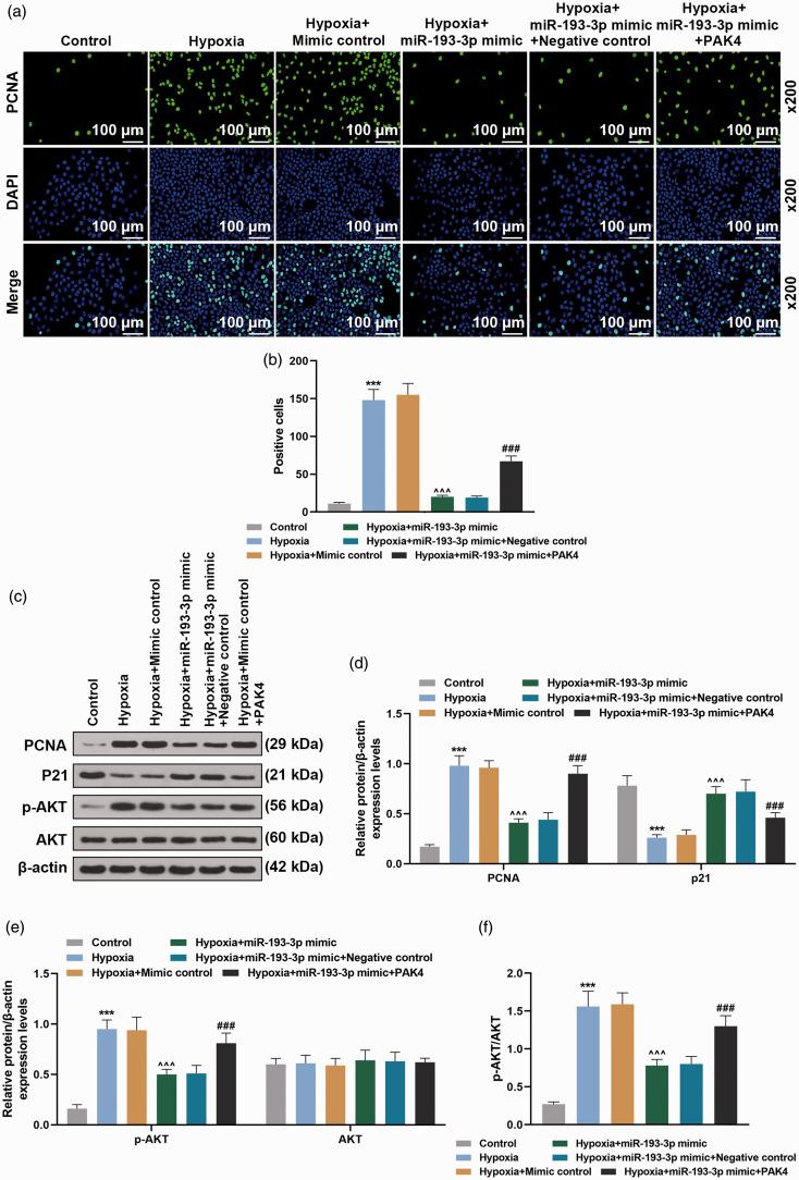 https://cdn.ncbi.nlm.nih.gov/pmc/blobs/68d0/7734527/2e90272a594f/10.1177_2045894020974919-fig4.jpg