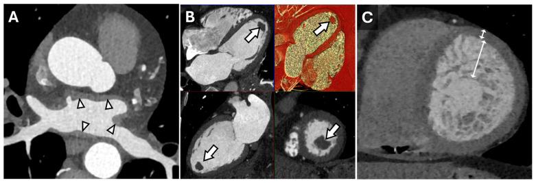 https://cdn.ncbi.nlm.nih.gov/pmc/blobs/68e0/11946596/15f8a4ff1c78/tomography-11-00039-g001.jpg