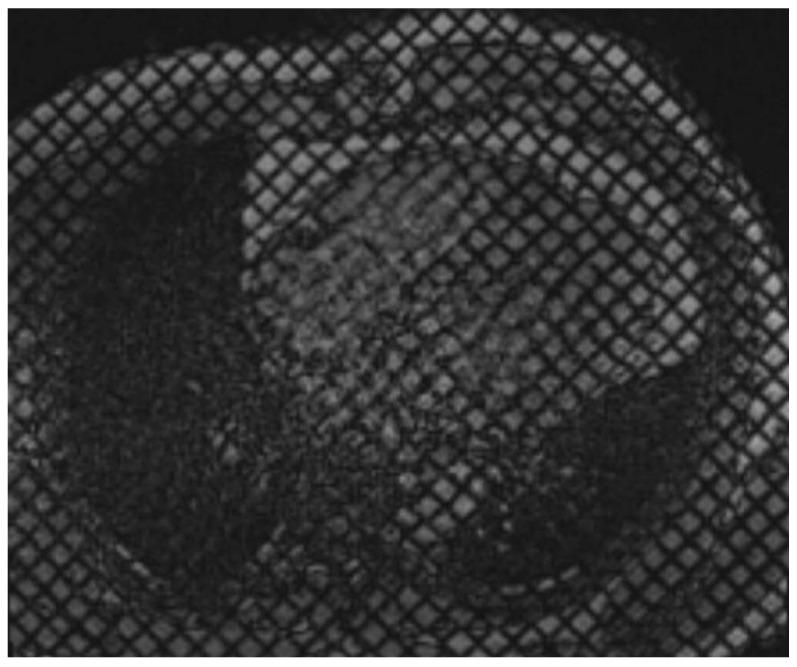 https://cdn.ncbi.nlm.nih.gov/pmc/blobs/68e0/11946596/5583c5dd10c6/tomography-11-00039-g004.jpg