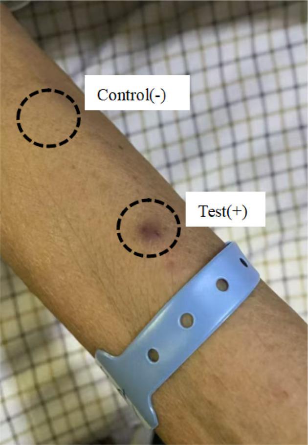 https://cdn.ncbi.nlm.nih.gov/pmc/blobs/68e3/12463969/da51f6a5628b/fimmu-16-1625126-g003.jpg