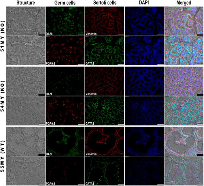 https://cdn.ncbi.nlm.nih.gov/pmc/blobs/68e3/9854396/e9b27035a6db/fgene-13-1078991-g003.jpg