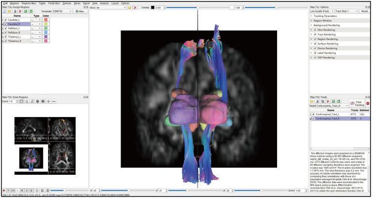 https://cdn.ncbi.nlm.nih.gov/pmc/blobs/68ea/12107389/43f66befd2e1/AMEP-16-875-g0008.jpg