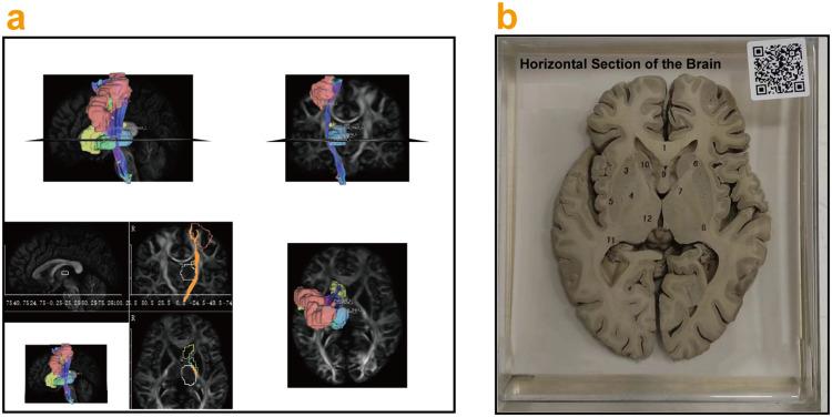 https://cdn.ncbi.nlm.nih.gov/pmc/blobs/68ea/12107389/5dd4b789fce9/AMEP-16-875-g0007.jpg