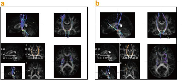 https://cdn.ncbi.nlm.nih.gov/pmc/blobs/68ea/12107389/de641a7bada8/AMEP-16-875-g0009.jpg