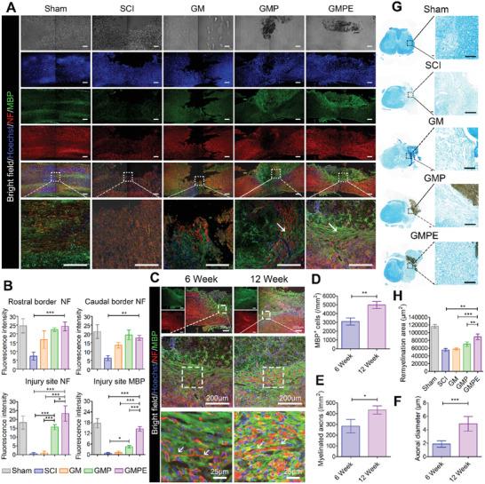 https://cdn.ncbi.nlm.nih.gov/pmc/blobs/68ed/9069372/f41ddc4f602a/ADVS-9-2105586-g006.jpg