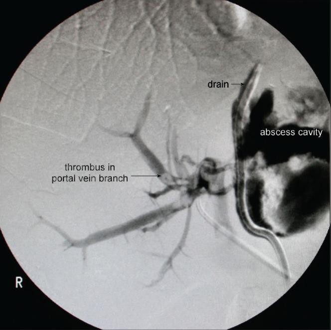 https://cdn.ncbi.nlm.nih.gov/pmc/blobs/68ef/3964669/f433d66c33e5/rcse9501-e8-02.jpg