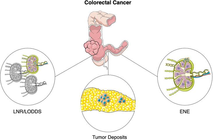 https://cdn.ncbi.nlm.nih.gov/pmc/blobs/68f0/9344134/b2b5f4946a4a/fonc-12-937114-g001.jpg