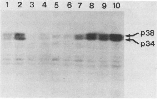https://cdn.ncbi.nlm.nih.gov/pmc/blobs/68f1/248820/536fd5290a54/jvirol00067-0675-a.jpg