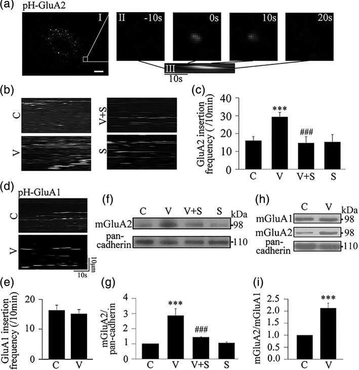 https://cdn.ncbi.nlm.nih.gov/pmc/blobs/68f4/6594043/a68f2473c973/GLIA-67-1344-g002.jpg