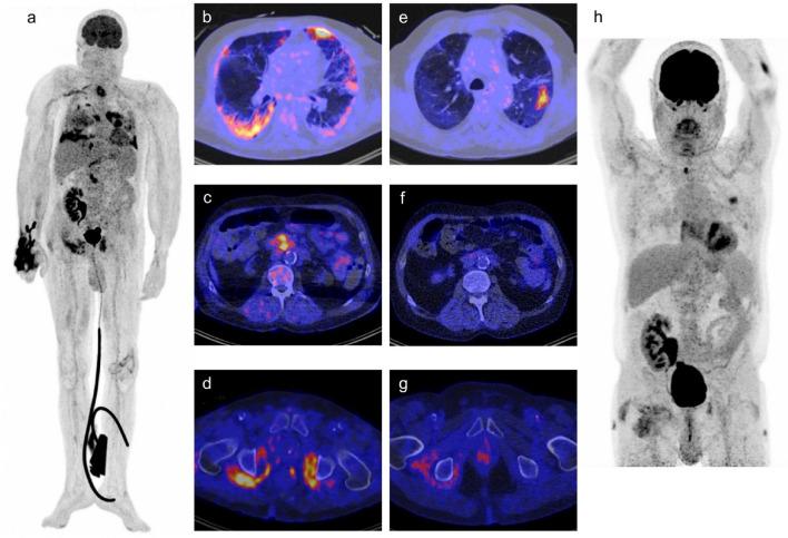 https://cdn.ncbi.nlm.nih.gov/pmc/blobs/6907/10008145/14175fb136d5/40336_2023_550_Fig1_HTML.jpg