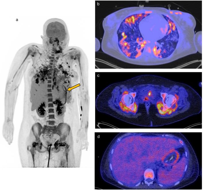 https://cdn.ncbi.nlm.nih.gov/pmc/blobs/6907/10008145/50bf8da52a92/40336_2023_550_Fig4_HTML.jpg